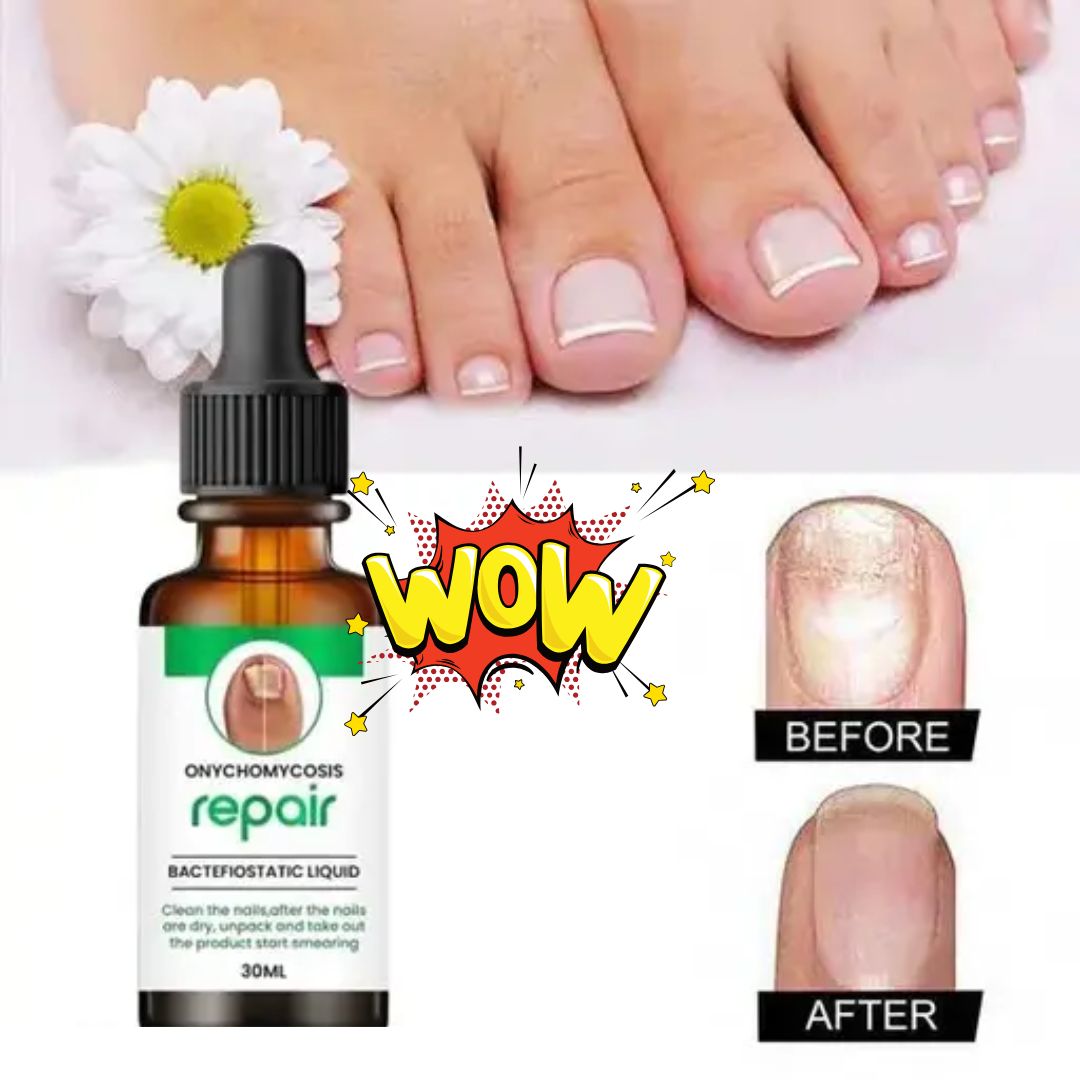 Nails Strong Growth And Repair Oil (BUY 1 GET 1 FREE)