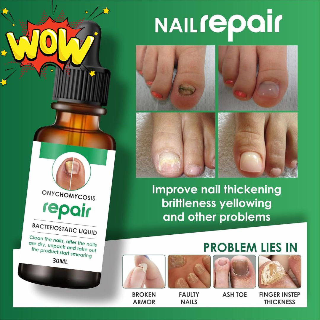 Nails Strong Growth And Repair Oil (BUY 1 GET 1 FREE)