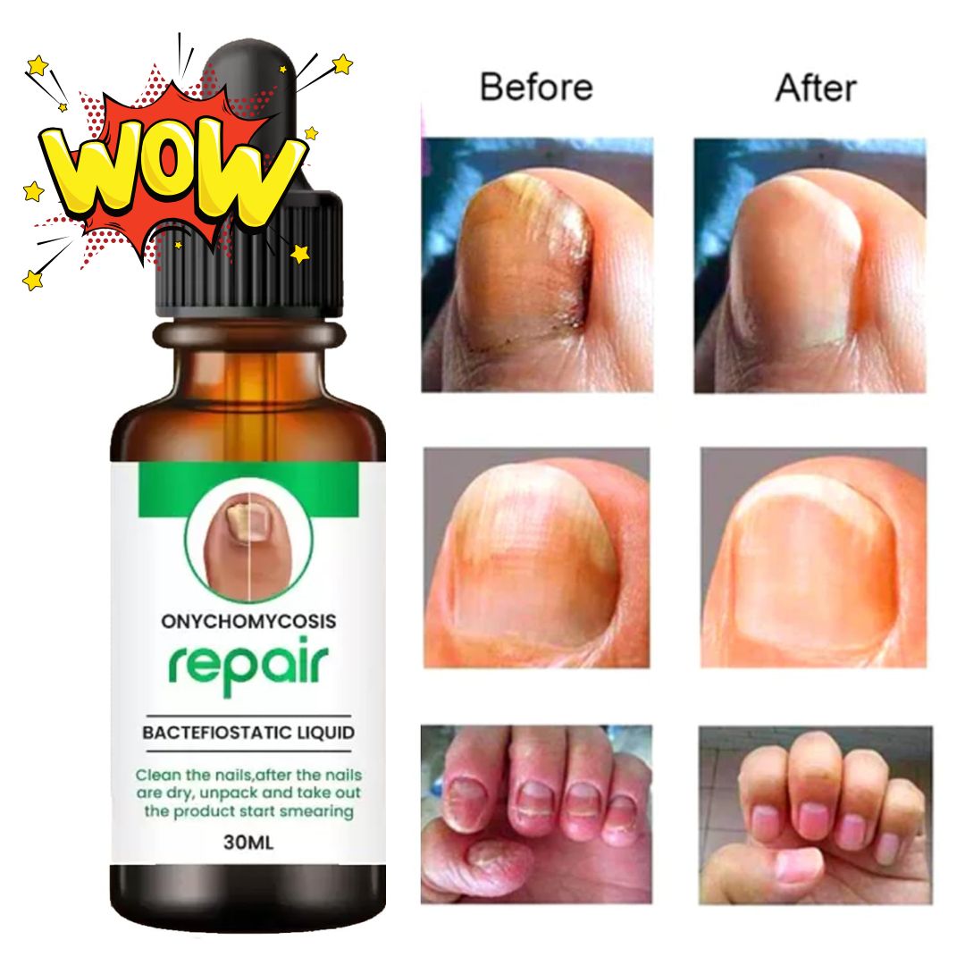 Nails Strong Growth And Repair Oil (BUY 1 GET 1 FREE)